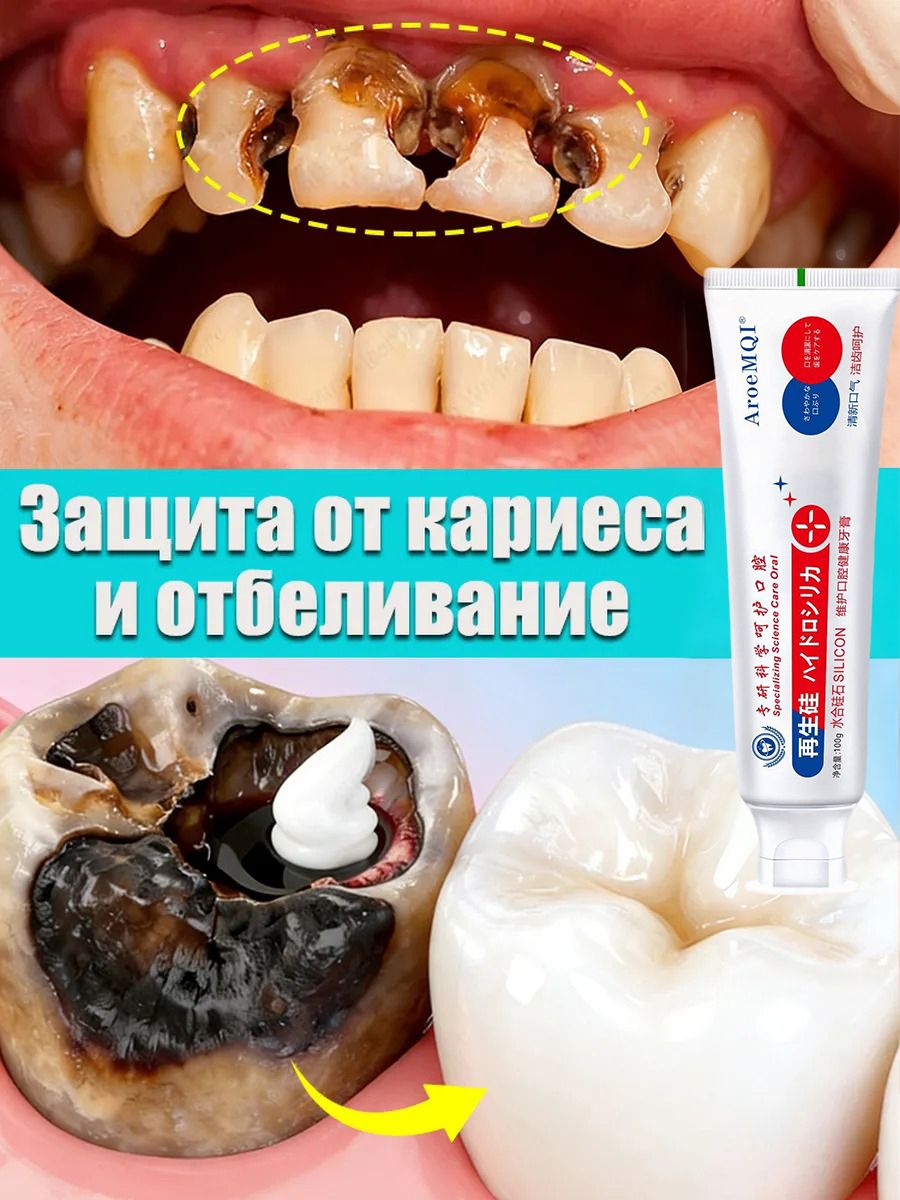 Зубнаяпастадлялечениядыркивзубе,глубокогокариесаипульпита,Снимаетболь,восстанавливаетприпоражениикариесомувзрослых,Свежеедыхание,100г,1шт.