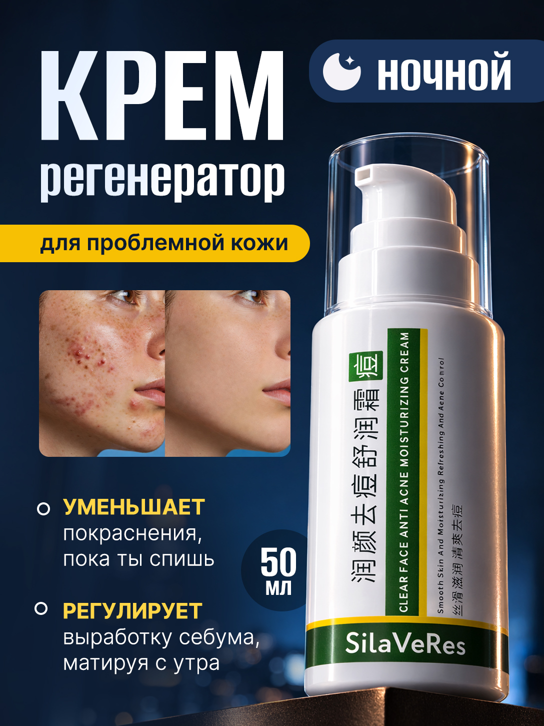 Ночнойкрем-регенератордлялицаSilaVeresдляпроблемнойкожикремотпрыщей,акнеипостакнесцинкомисалициловойкислотой,50мл